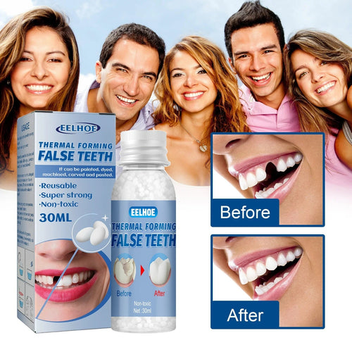 Eelhoe Temporary Tooth Repair: Perfect Solution for Gaps and Missing Teeth!✨