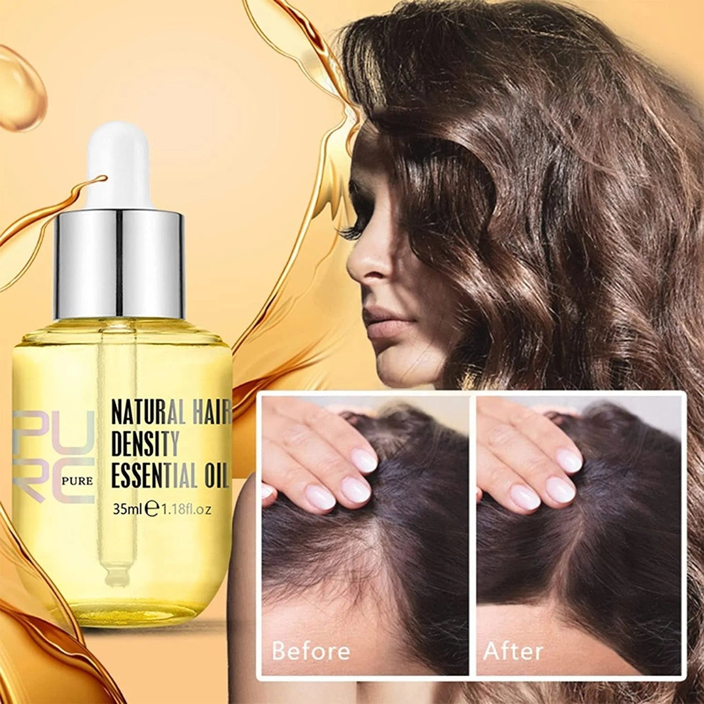 🌿 PURC Ginger Hair Growth Essence Oil – Rediscover Your Full, Beautiful Hair